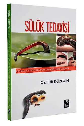 Sülük Tedavisi Kitabı (Özgür Düzgün)-1576 - 1